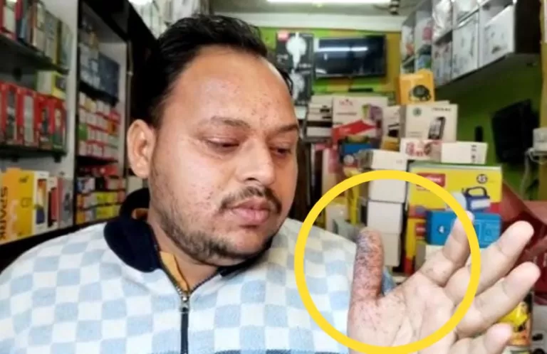 SAGAR: खिमलासा में चली गोली, कार सवार दो लोगों ने मोबाइल दुकानदार पर चलाई गोली