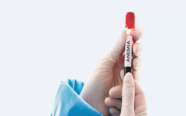 एनीमिया को लेकर स्वास्थ्य विभाग ने एडवाइजरी जारी की