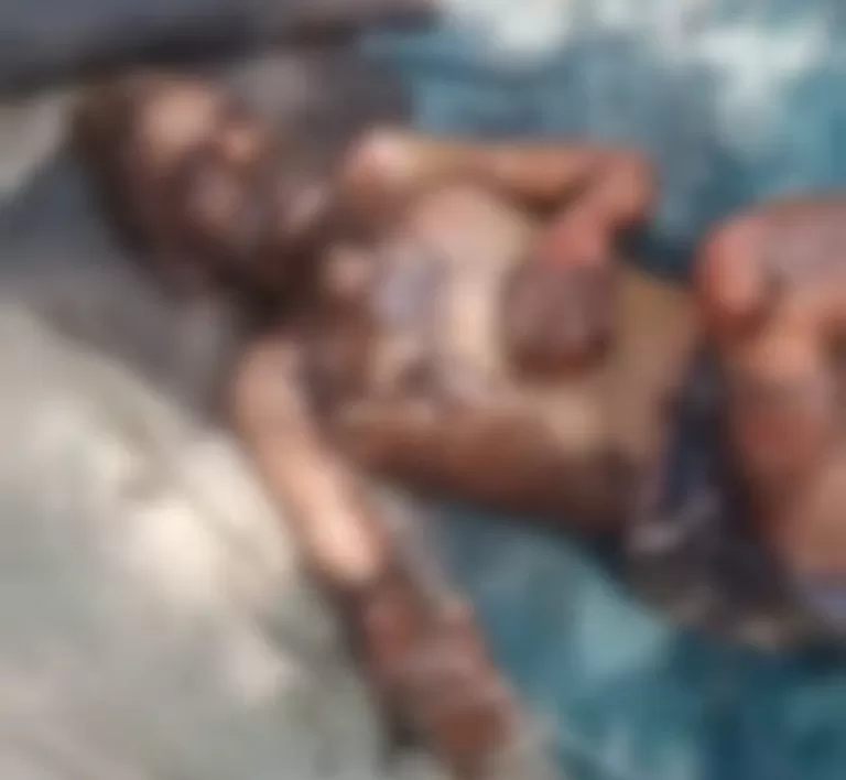 गालीगलौज और मारपीट से आहत व्यक्ति ने खुद को आग लगाई, बीएमसी में भर्ती