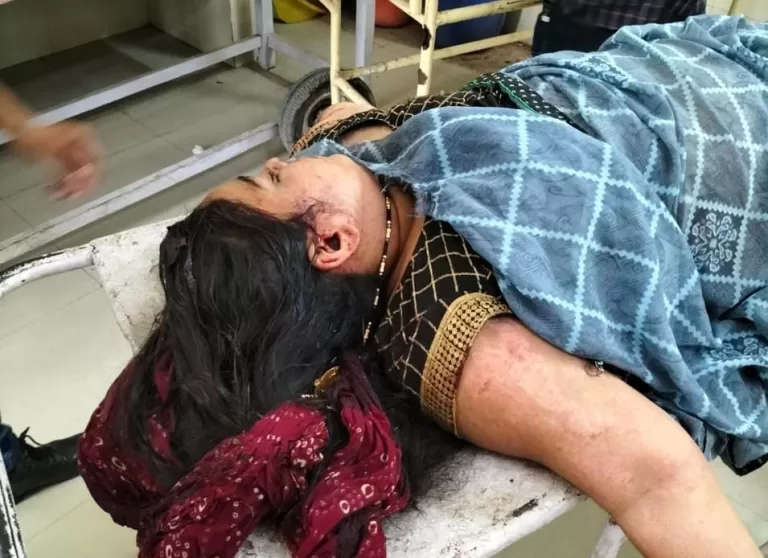 मोटरसाइकिल पर बैठी महिला की साड़ी पहिये में उलझ गई, गंभीर घायल