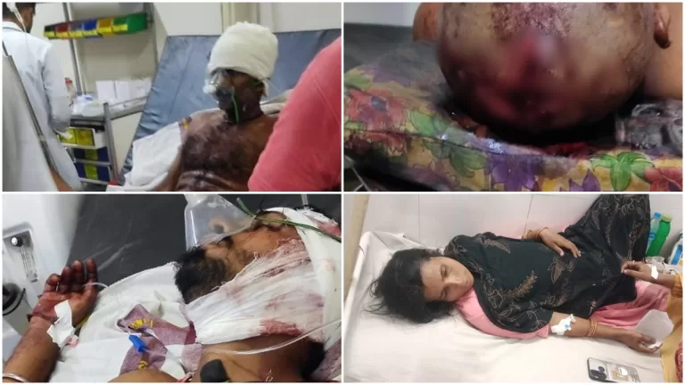 कुएं से पानी लेने पर 2 भाईयो में विवाद इतना बड़ा की खून बह गया