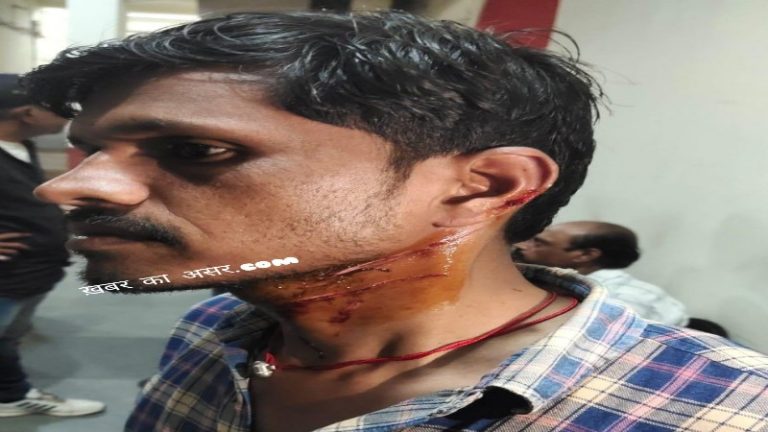 सागर में कटरबाज गैंग ने लूट का प्रयास कर छुरे चलाये, पुराने अधिकारी की रही अधूरी कार्यवाई !