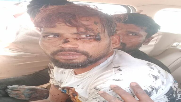 हवाई अड्डे की नई बिल्डिंग में केमीकल सिलेंडर फटा, मजूदर घायल