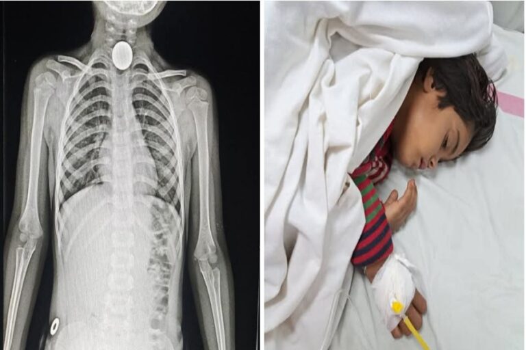 जिला चिकित्सालय में चिकित्सा टीम ने फिर बचाई एक नन्ही जान